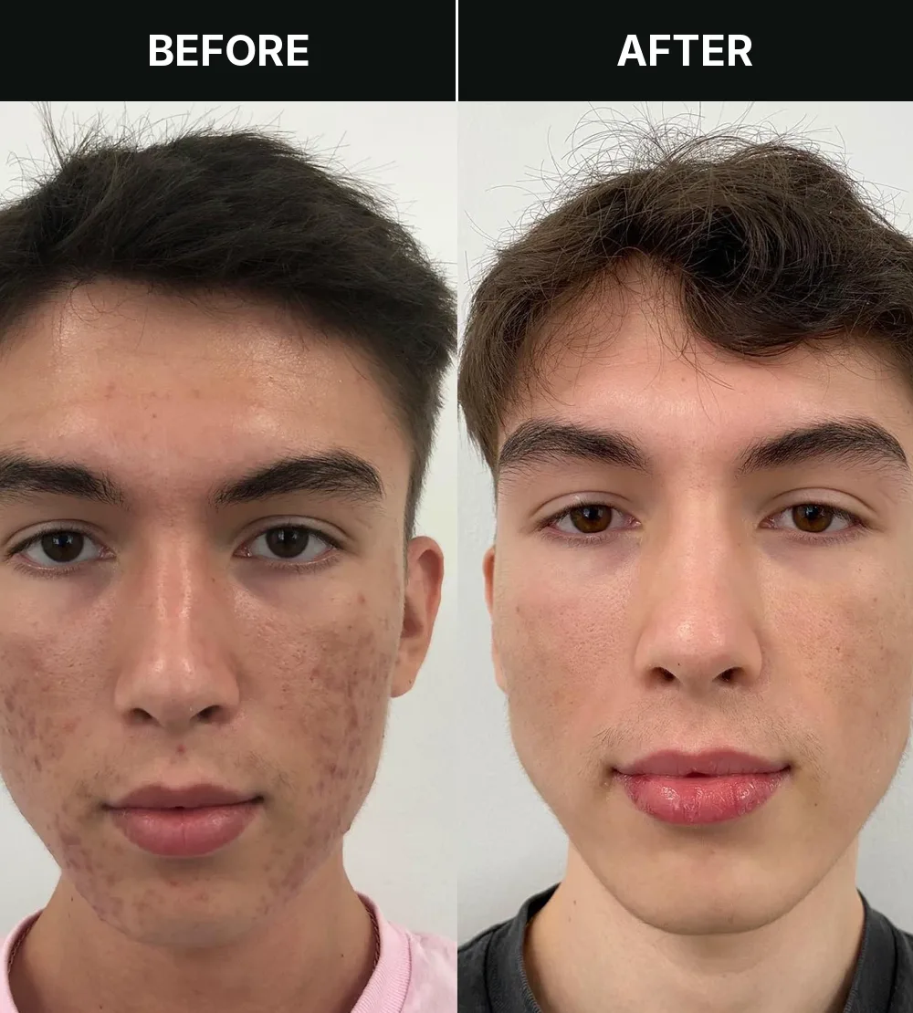 Customer 1, before and after treatment