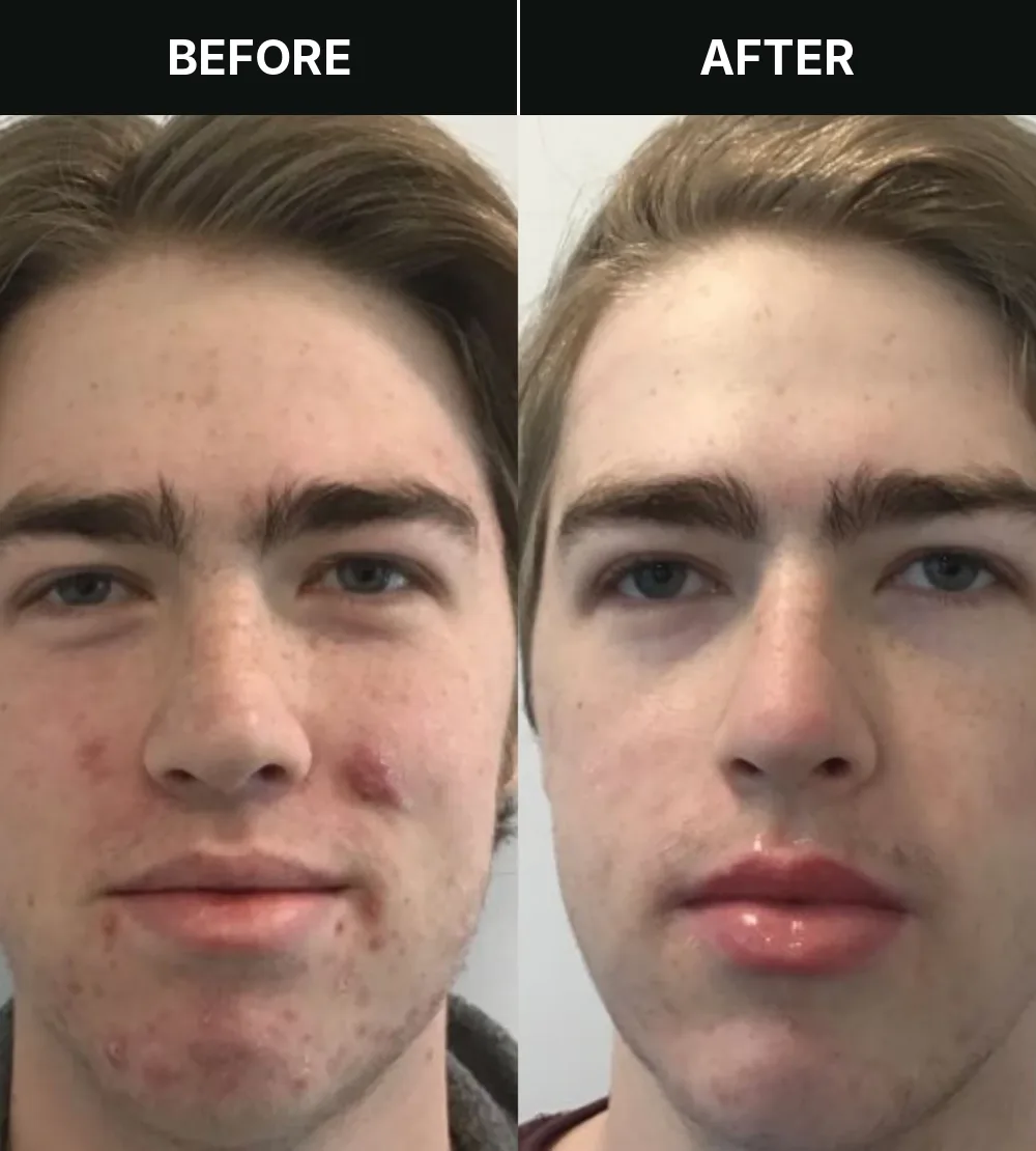 Customer 4, before and after treatment